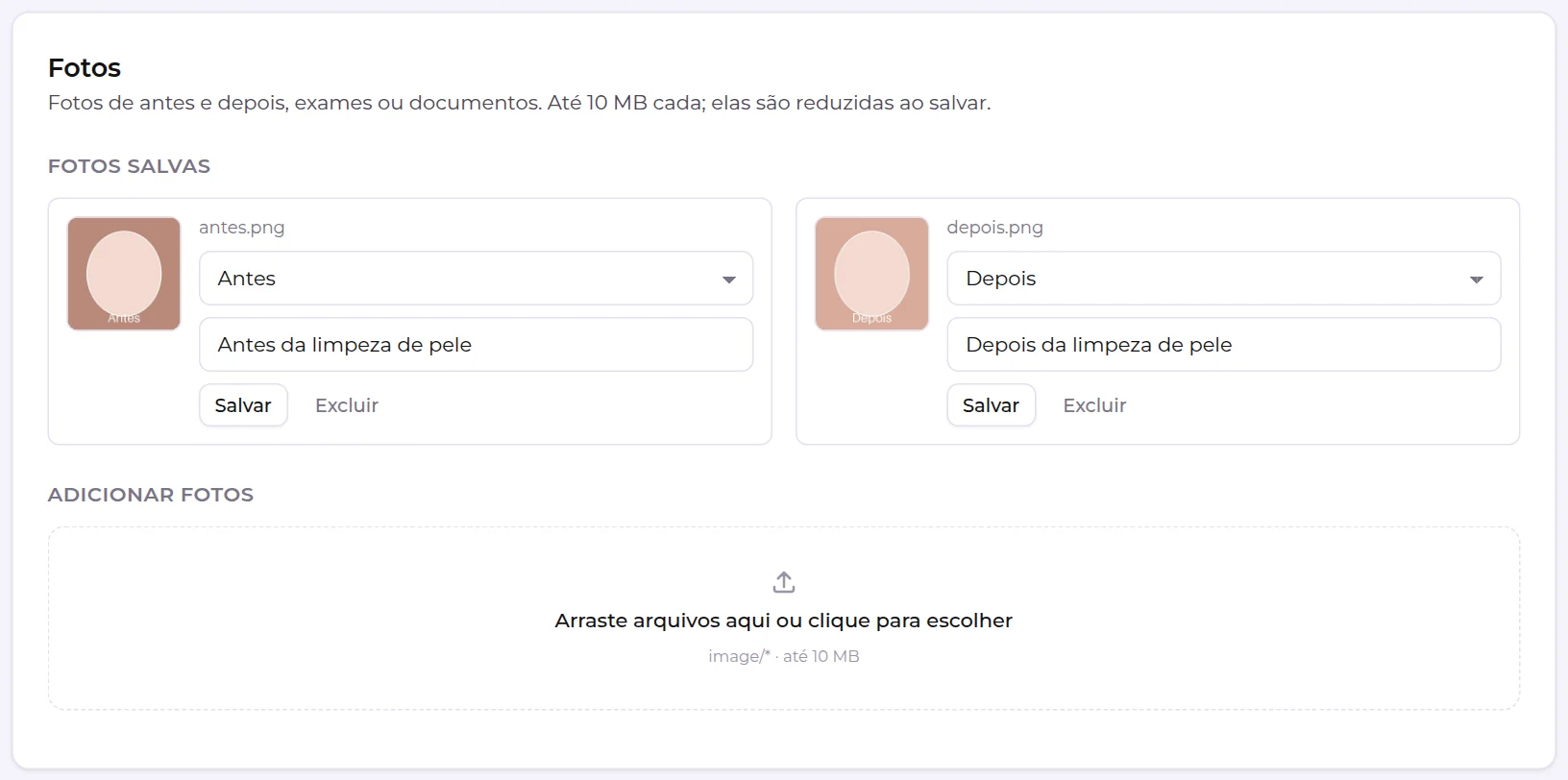 Bloco Fotos de um atendimento, com as fotos salvas de antes e depois e a área para adicionar novas fotos